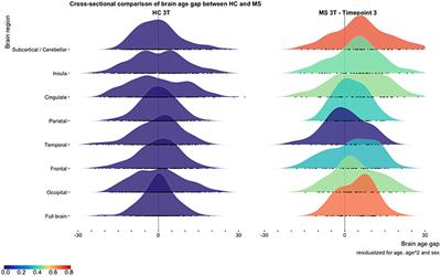 Cross-Sectional and Longitudinal MRI Brain Scans Reveal Accelerated Brain Aging in Multiple Sclerosis